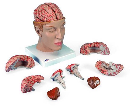Πρόπλασμα Ανθρώπινου Εγκεφάλου C25